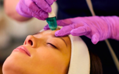 descubre los tratamientos de medicina estetica faciales para rejuvenecer tu piel